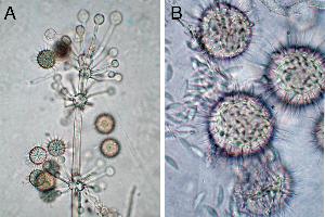 Sporophore (Fig A) and sporangiolum (Fig B) of Hesseltinella vesiculosa - Photo credit: Gerald Benny