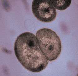 Home - Deinococcus geothermalis DSM 11300