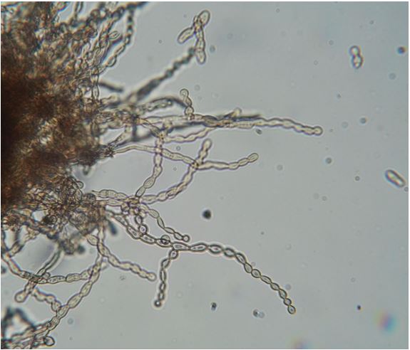 Hyphae of Epibryaceae sp. under a light microscope. Image courtesy of Laura Selbmann.